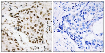 B23 (phospho-Thr199) antibody