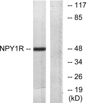NPY1-R rabbit pAb