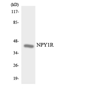 NPY1-R rabbit pAb