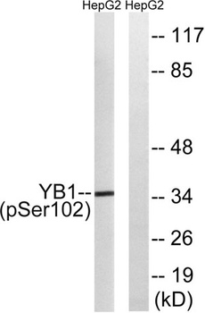 YB-1 (phospho Ser102) rabbit pAb