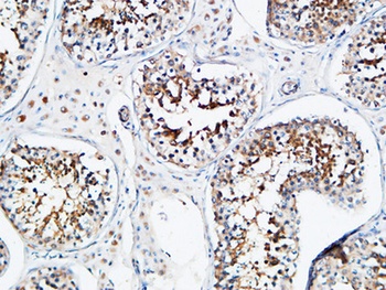 YB-1 antibody