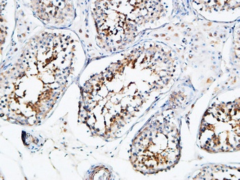 YB-1 antibody