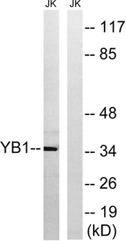 YB-1 antibody