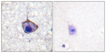 Trk A (phospho Tyr791) rabbit pAb