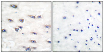 Trk A (phospho Tyr791) rabbit pAb