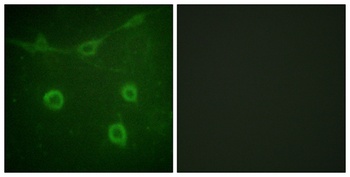 Trk A (phospho-Tyr496) antibody