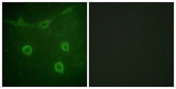 Trk A (phospho Tyr496) rabbit pAb