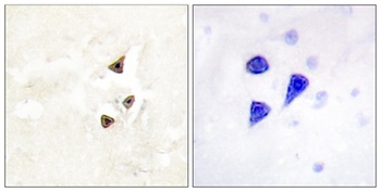 Trk B (phospho Tyr516) rabbit pAb