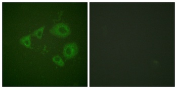 Trk B (phospho Tyr706) rabbit pAb