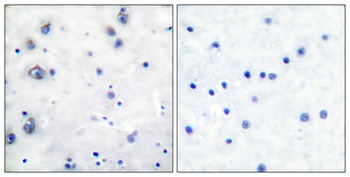 TrkB antibody