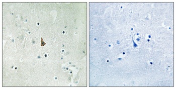 Trk C (phospho Tyr516) rabbit pAb