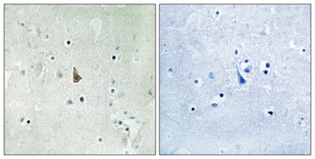 Trk C (phospho-Tyr516) antibody