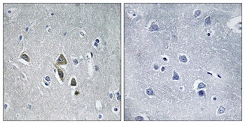 AZ1 rabbit pAb Antibody