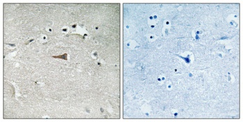 DOR-1 (phospho Ser363) rabbit pAb
