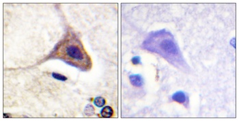 DOR-1 (phospho Ser363) rabbit pAb