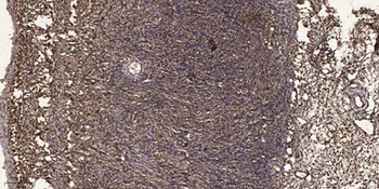 KOR-1 antibody