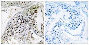 P3 antibody