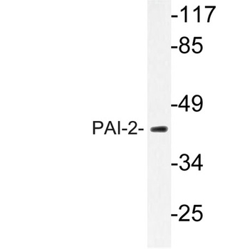 PAI-2 antibody