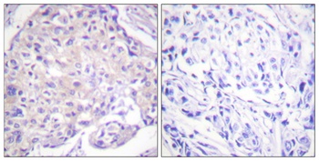 PAK alpha (phospho-Thr212) antibody