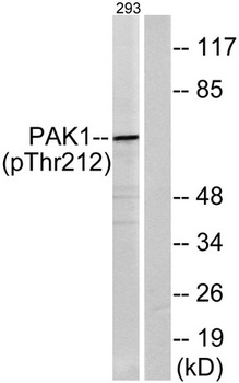 PAK alpha (phospho-Thr212) antibody