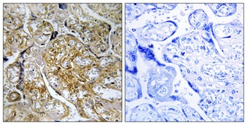 PAK alpha (phospho-Ser199) antibody