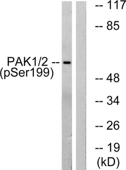 PAK alpha (phospho-Ser199) antibody