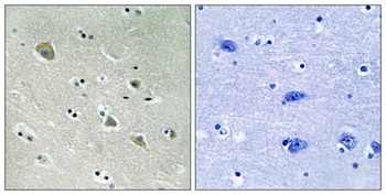 PAK alpha (phospho-Ser204) antibody