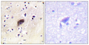 PAK alpha/beta/gamma (phospho-Ser144/141/139) antibody