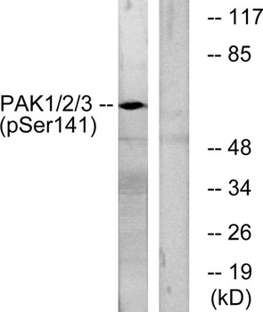 PAK alpha/beta/gamma (phospho-Ser144/141/139) antibody