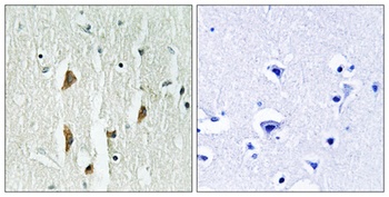 PAK alpha/beta/gamma antibody