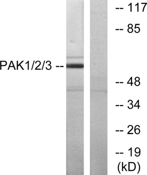 PAK alpha/beta/gamma antibody