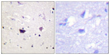 PAKα/β/γ rabbit pAb