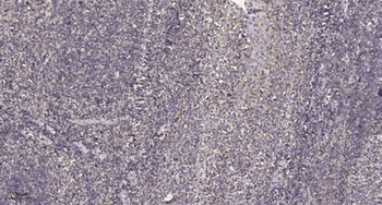 PAKγ (phospho Ser141) rabbit pAb
