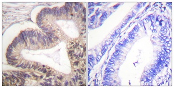 PAK gamma (phospho-Ser20) antibody