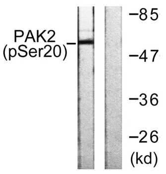 PAK gamma (phospho-Ser20) antibody