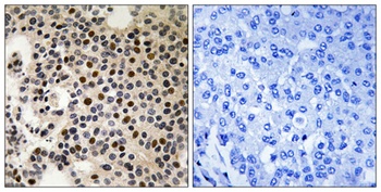 PAKγ (phospho Ser197) rabbit pAb