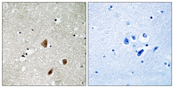 PAK beta (phospho-Ser154) antibody