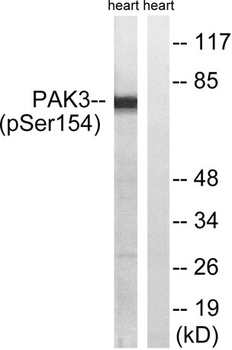 PAK beta (phospho-Ser154) antibody