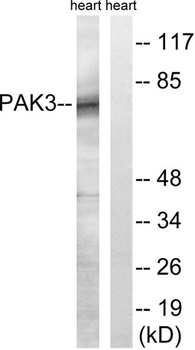 PAK beta antibody