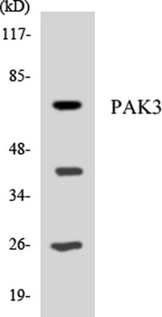 PAK beta antibody
