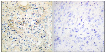 NGEP antibody