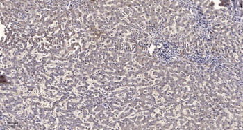 T2R1 antibody