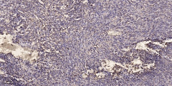 T2R13 antibody