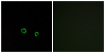 T2R10 rabbit pAb Antibody