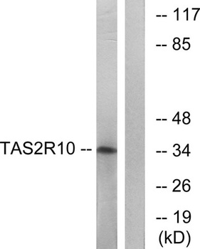 T2R10 rabbit pAb
