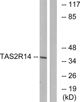 T2R14 antibody