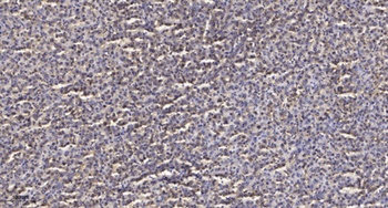 T2R14 antibody