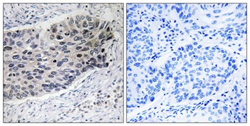 PCB antibody