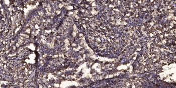Sclerostin rabbit pAb