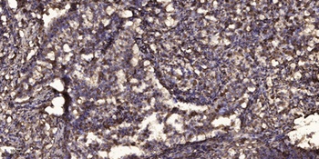 Sclerostin antibody